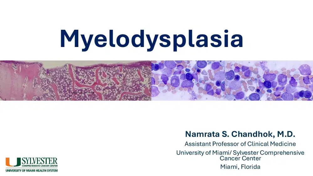 2025 MCM | Myelodysplasia