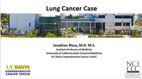 Lung Cancer Case