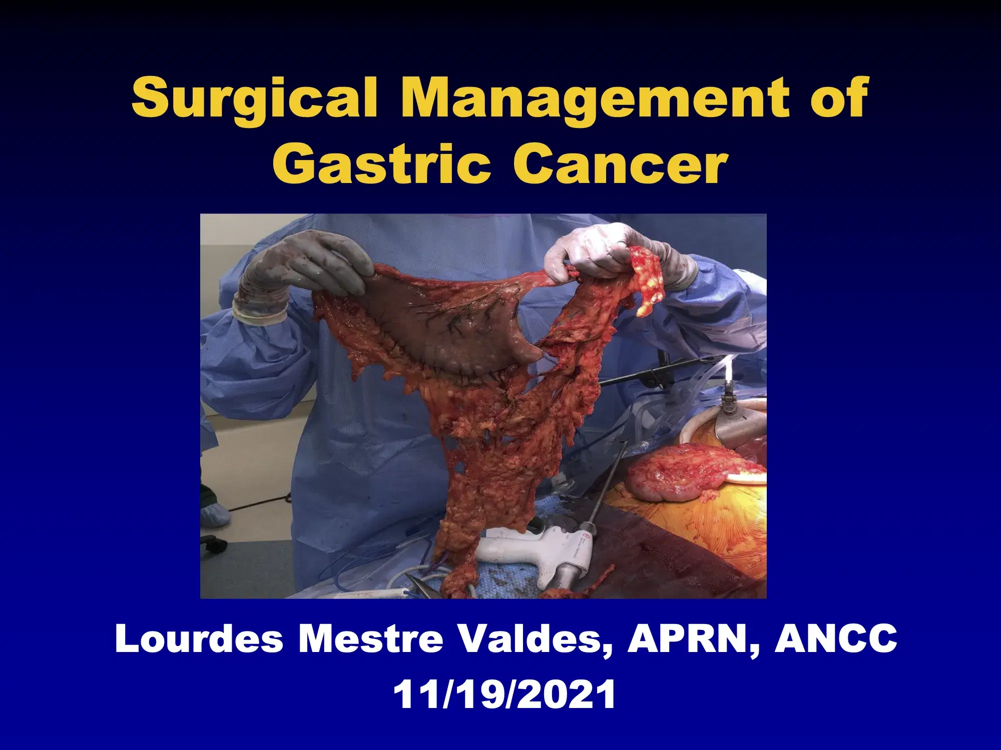 2021 NOSCM | Surgical Management of High-Risk Gastric Patients