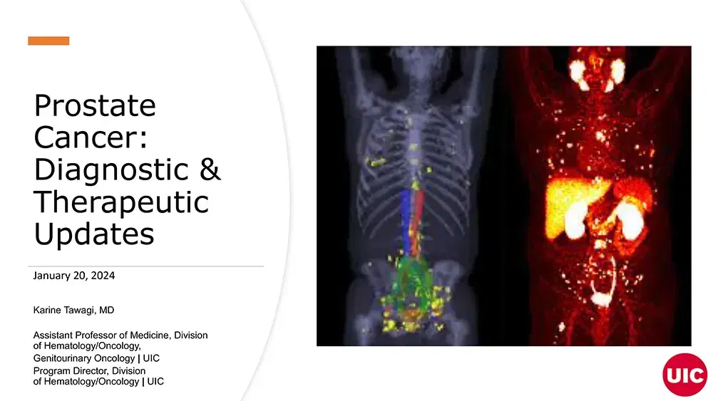 2024 MCM | Prostate Cancer: Diagnostic and Therapeutic Updates