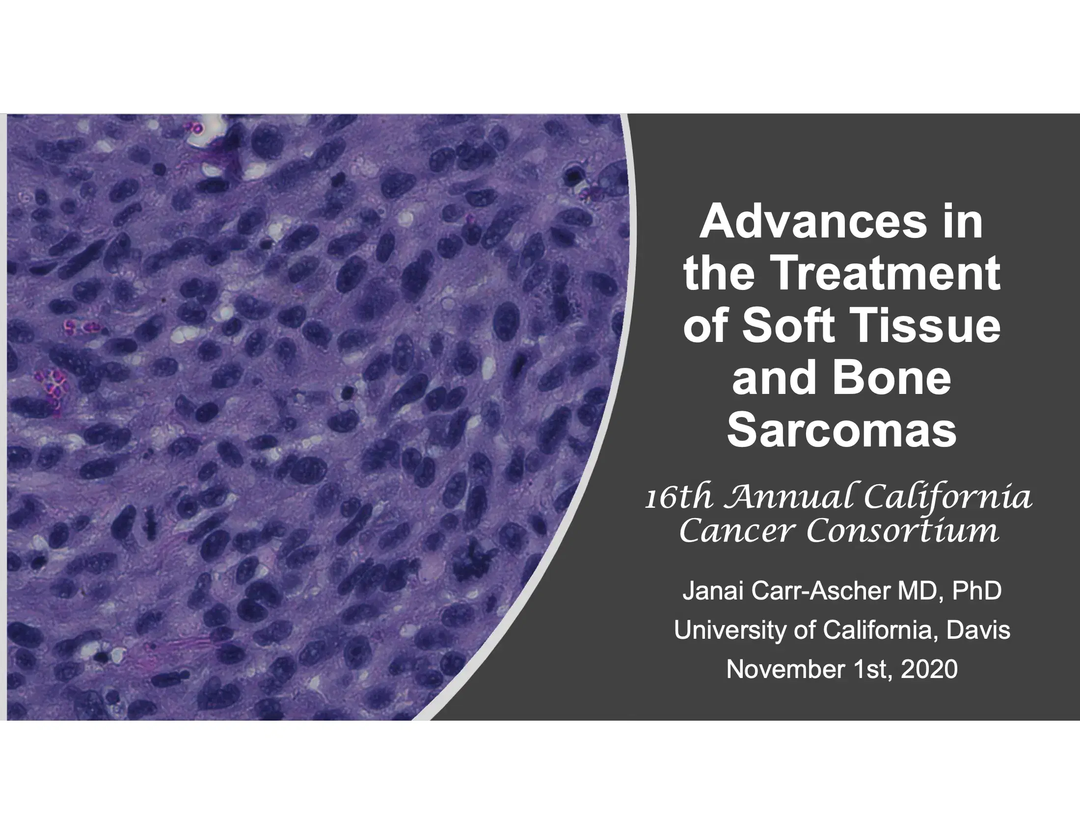 Advances in the Treatment of Soft Tissue and Bone Sarcomas