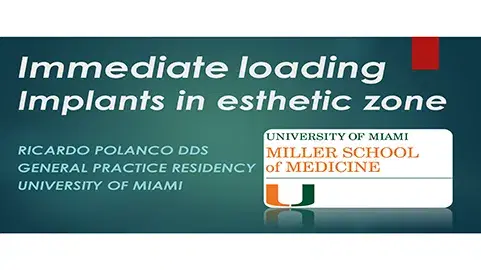 Immediate Loading Implants in Esthetic Zone