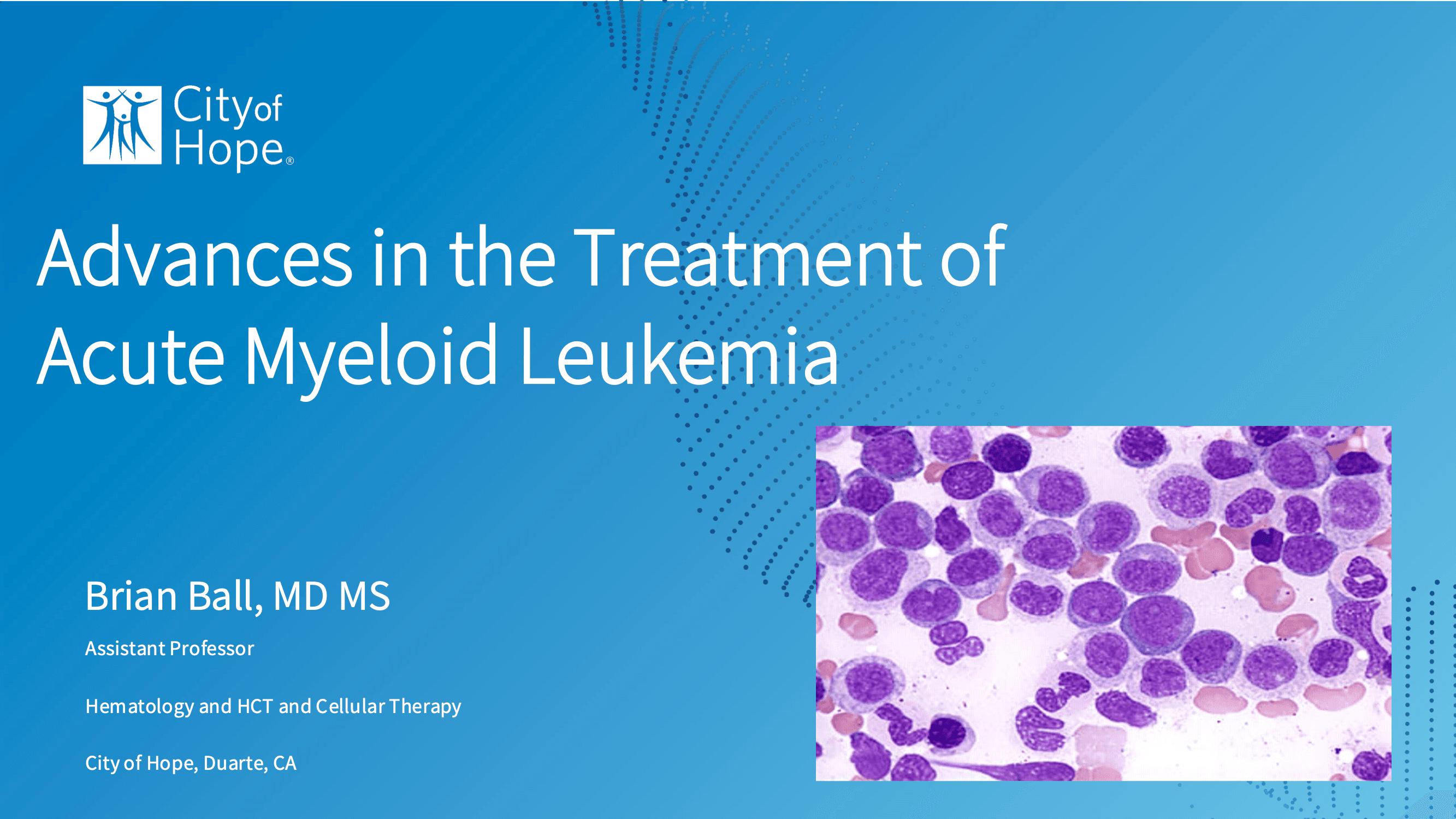 2026 CCC | Advances in the Treatment of Acute Myeloid Leukemia